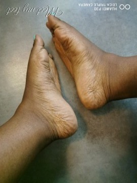 EbenFeet EbenFeet